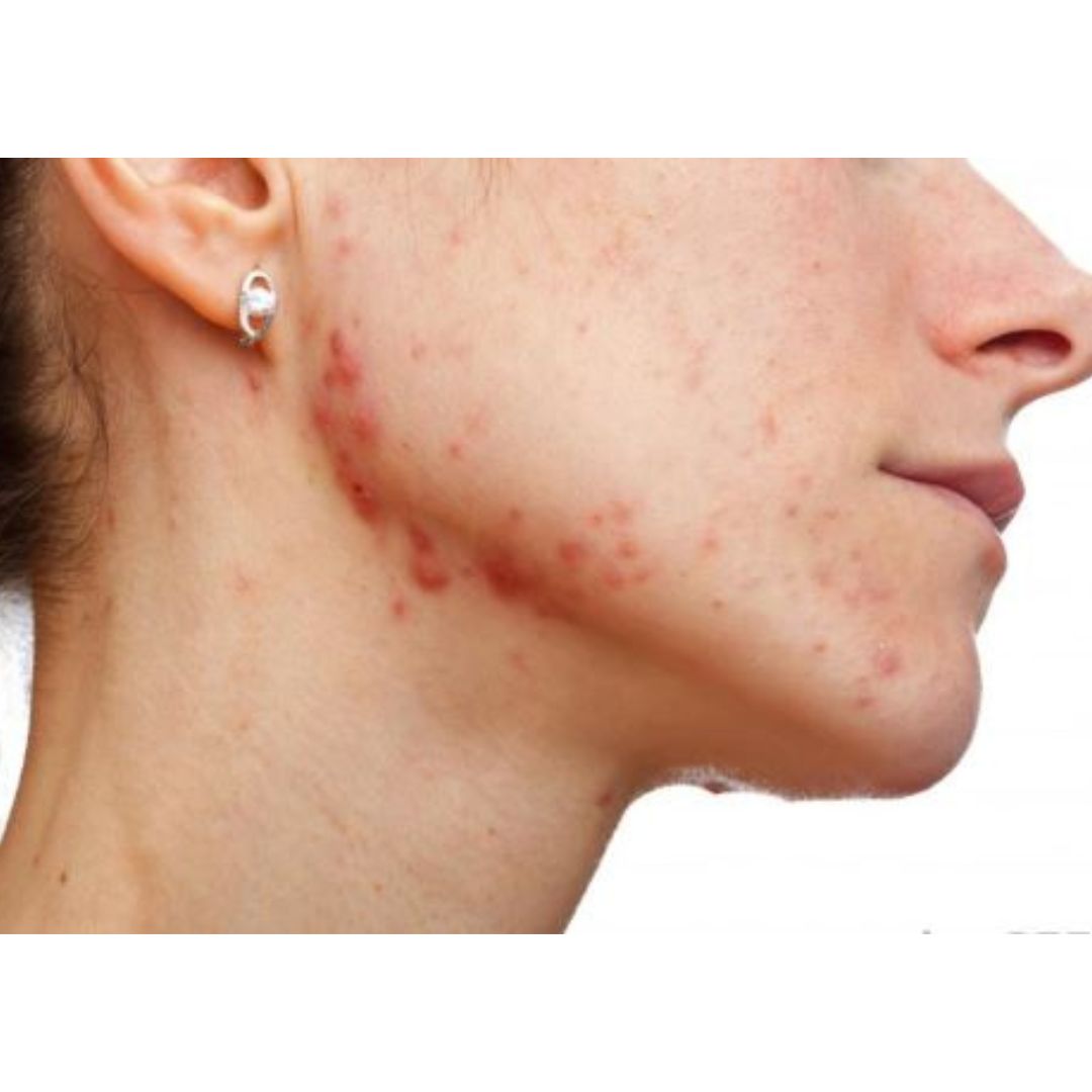 Best Guidance For Makeup Side Effect