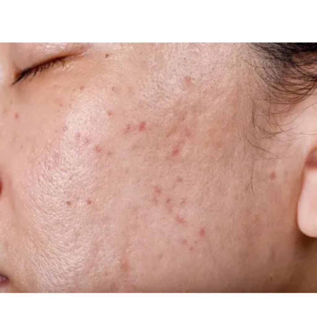 Untitled design 93 1