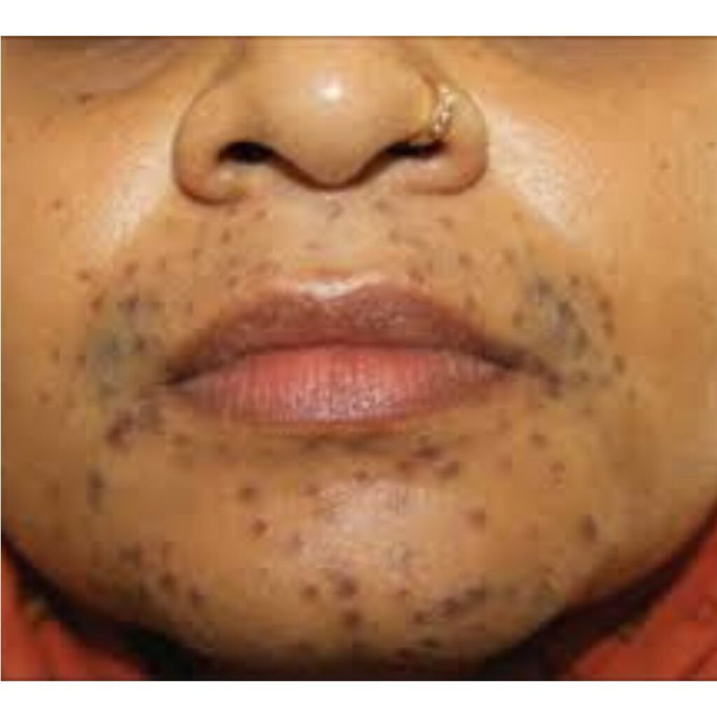 Untitled design 96 1